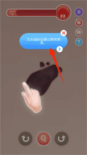 挤痘痘达人